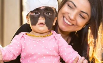 Little girl born with ‘Batman’ birthmark can’t close one eye after removal ops